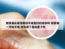 银屑病从痒发展到不痒是好的症状吗 银屑病一开始不痒,现在痒了是加重了吗