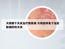 大同那个大夫治疗银屑病 大同南郊有个治皮肤病好的大夫