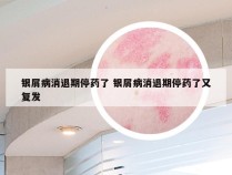 银屑病消退期停药了 银屑病消退期停药了又复发