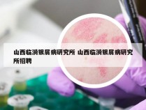 山西临漪银屑病研究所 山西临漪银屑病研究所招聘