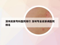 深圳皮肤专科医院排行 深圳专业皮肤病医院排名