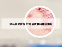 驻马店皮肤科 驻马店皮肤科哪治得好