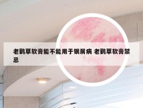 老鹳草软膏能不能用于银屑病 老鹳草软膏禁忌