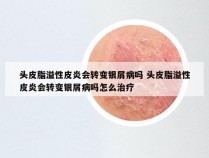 头皮脂溢性皮炎会转变银屑病吗 头皮脂溢性皮炎会转变银屑病吗怎么治疗