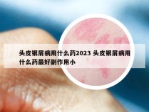 头皮银屑病用什么药2023 头皮银屑病用什么药最好副作用小