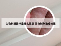 生物制剂治疗是什么意思 生物制剂治疗效果