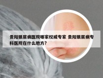 贵阳银屑病医院哪家权威专家 贵阳银屑病专科医院在什么地方?
