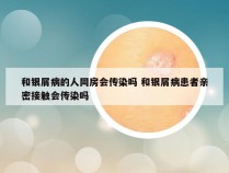 和银屑病的人同房会传染吗 和银屑病患者亲密接触会传染吗