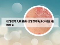 桂芝茯苓丸银屑病 桂芝茯苓丸多少钱盒,在哪里买