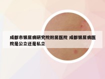 成都市银屑病研究院附属医院 成都银屑病医院是公立还是私立