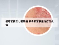 狼毒苦参三七银屑病 狼毒和苦参是治疗什么病