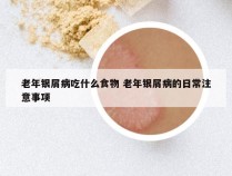老年银屑病吃什么食物 老年银屑病的日常注意事项