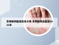 生物制剂医保后多少钱 生物制剂进医保2021年