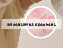 银屑病吃什么预防复发 银屑病避免吃什么