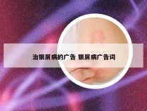 治银屑病的广告 银屑病广告词