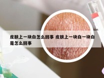 皮肤上一块白怎么回事 皮肤上一块白一块白是怎么回事