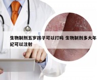 生物制剂五岁孩子可以打吗 生物制剂多大年纪可以注射