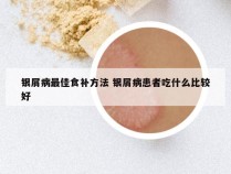 银屑病最佳食补方法 银屑病患者吃什么比较好