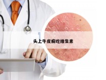 头上牛皮癣吃维生素