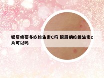 银屑病要多吃维生素C吗 银屑病吃维生素c片可以吗