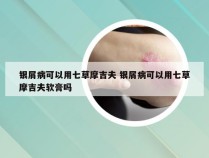 银屑病可以用七草摩吉夫 银屑病可以用七草摩吉夫软膏吗