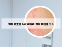 银屑病查什么可以确诊 银屑病检查什么