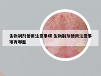 生物制剂使用注意事项 生物制剂使用注意事项有哪些