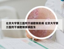 北京大学第三医院干细胞银屑病 北京大学第三医院干细胞银屑病医生