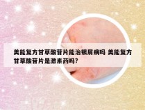 美能复方甘草酸苷片能治银屑病吗 美能复方甘草酸苷片是激素药吗?