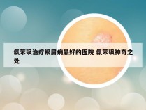 氨苯砜治疗银屑病最好的医院 氨苯砜神奇之处