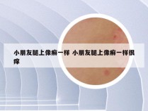 小朋友腿上像癣一样 小朋友腿上像癣一样很痒