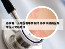 泰安有什么中医看牛皮癣好 泰安银屑病医院中医研究所地址