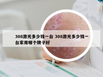 308激光多少钱一台 308激光多少钱一台家用哪个牌子好