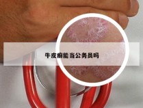 牛皮癣能当公务员吗