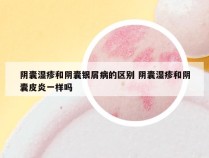 阴囊湿疹和阴囊银屑病的区别 阴囊湿疹和阴囊皮炎一样吗