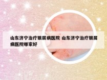 山东济宁治疗银屑病医院 山东济宁治疗银屑病医院哪家好