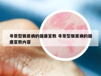 寻常型银屑病的健康宣教 寻常型银屑病的健康宣教内容