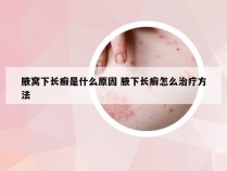 腋窝下长癣是什么原因 腋下长癣怎么治疗方法