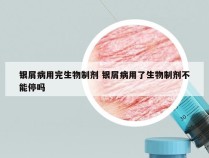 银屑病用完生物制剂 银屑病用了生物制剂不能停吗