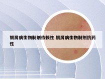 银屑病生物制剂依赖性 银屑病生物制剂抗药性