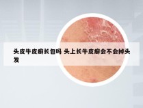 头皮牛皮癣长包吗 头上长牛皮癣会不会掉头发