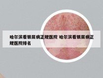 哈尔滨看银屑病正规医院 哈尔滨看银屑病正规医院排名