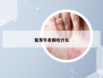 复发牛皮癣吃什么