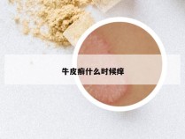 牛皮癣什么时候痒