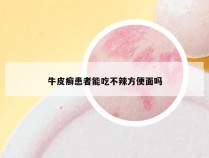牛皮癣患者能吃不辣方便面吗