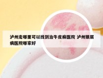 泸州走哪里可以找到治牛皮癣医院 泸州银屑病医院哪家好