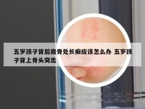 五岁孩子背后扇骨处长癣应该怎么办 五岁孩子背上骨头突出