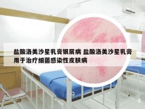 盐酸洛美沙星乳膏银屑病 盐酸洛美沙星乳膏用于治疗细菌感染性皮肤病