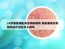 14岁银屑病能用生物制剂吗 银屑病用生物制剂治疗还能生小孩吗