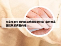 南京哪里有好的银屑病医院比较好 南京哪家医院银屑病看的好